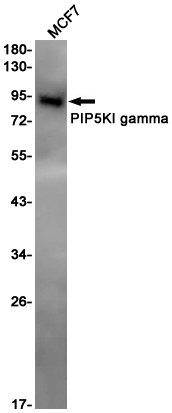 PIP5KI gamma Rabbit mAb