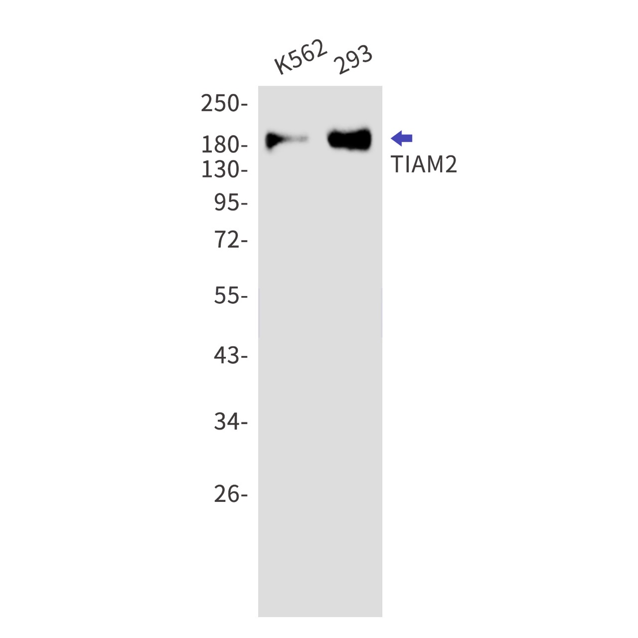 TIAM2 Rabbit mAb
