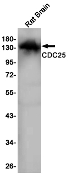 RASGRF1 Rabbit mAb
