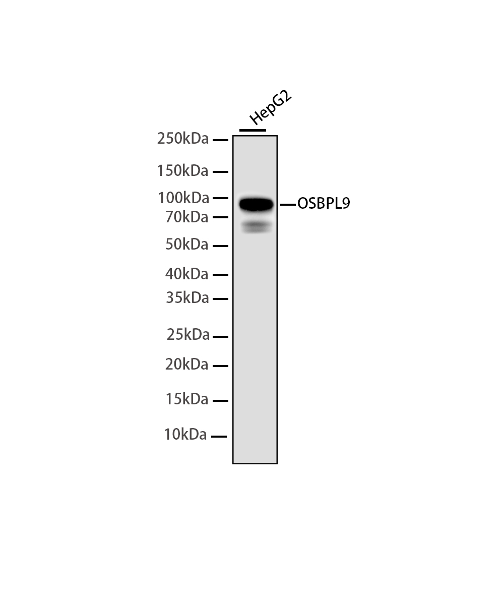 OSBPL9 Rabbit mAb