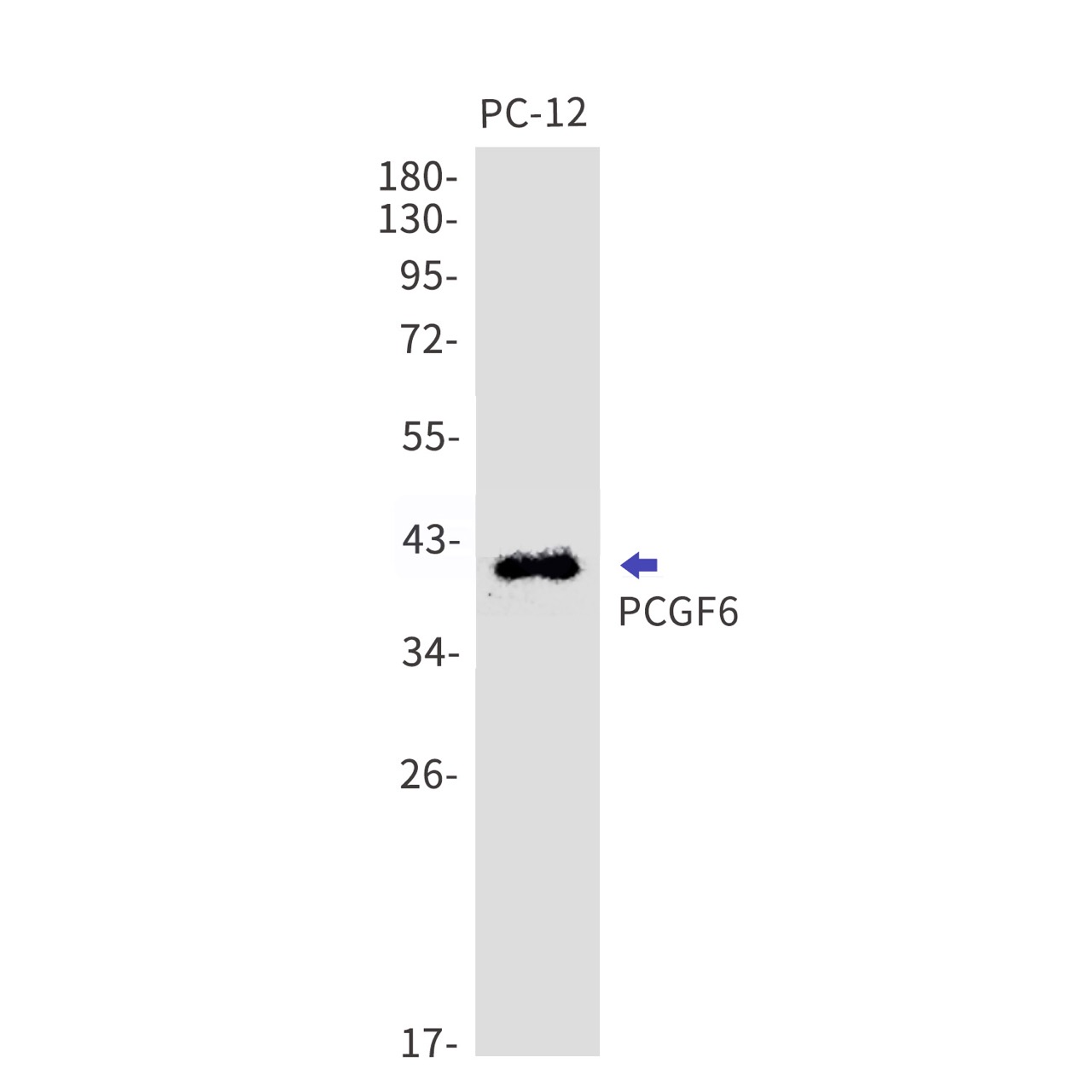PCGF6 Rabbit mAb