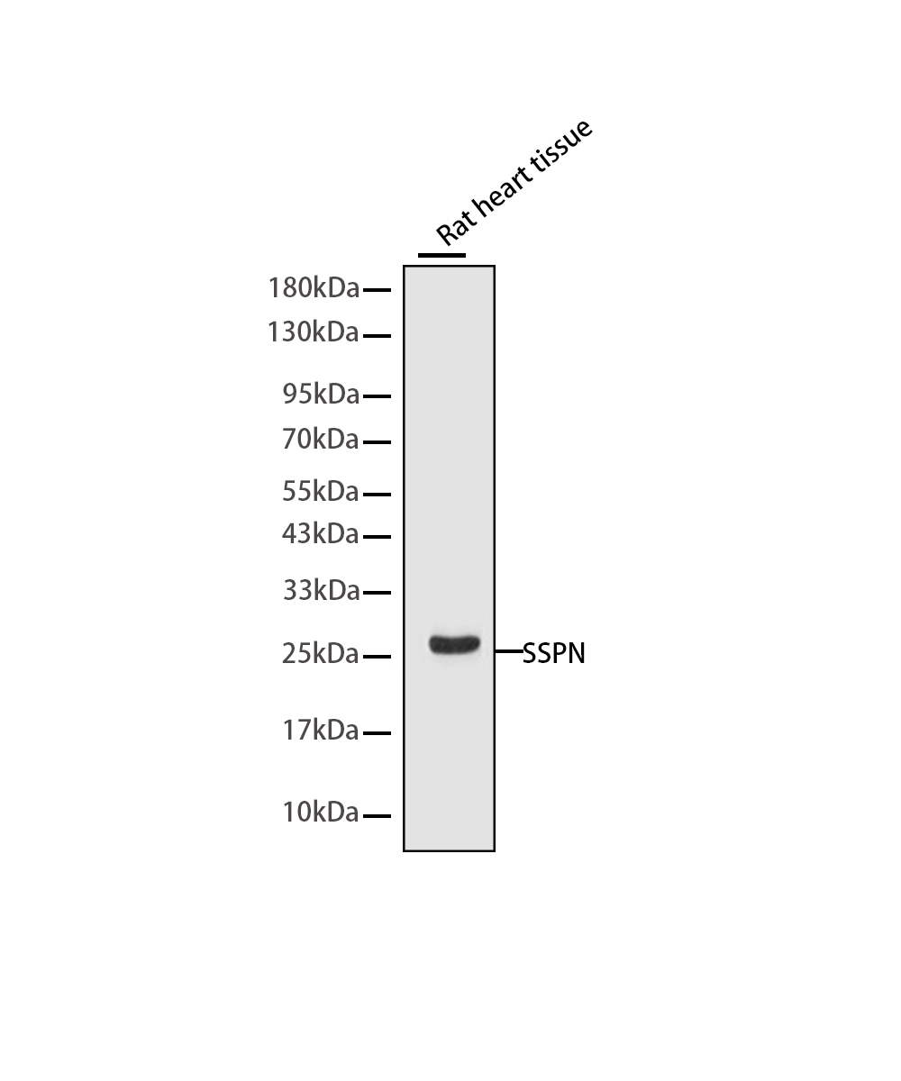 SSPN Rabbit mAb