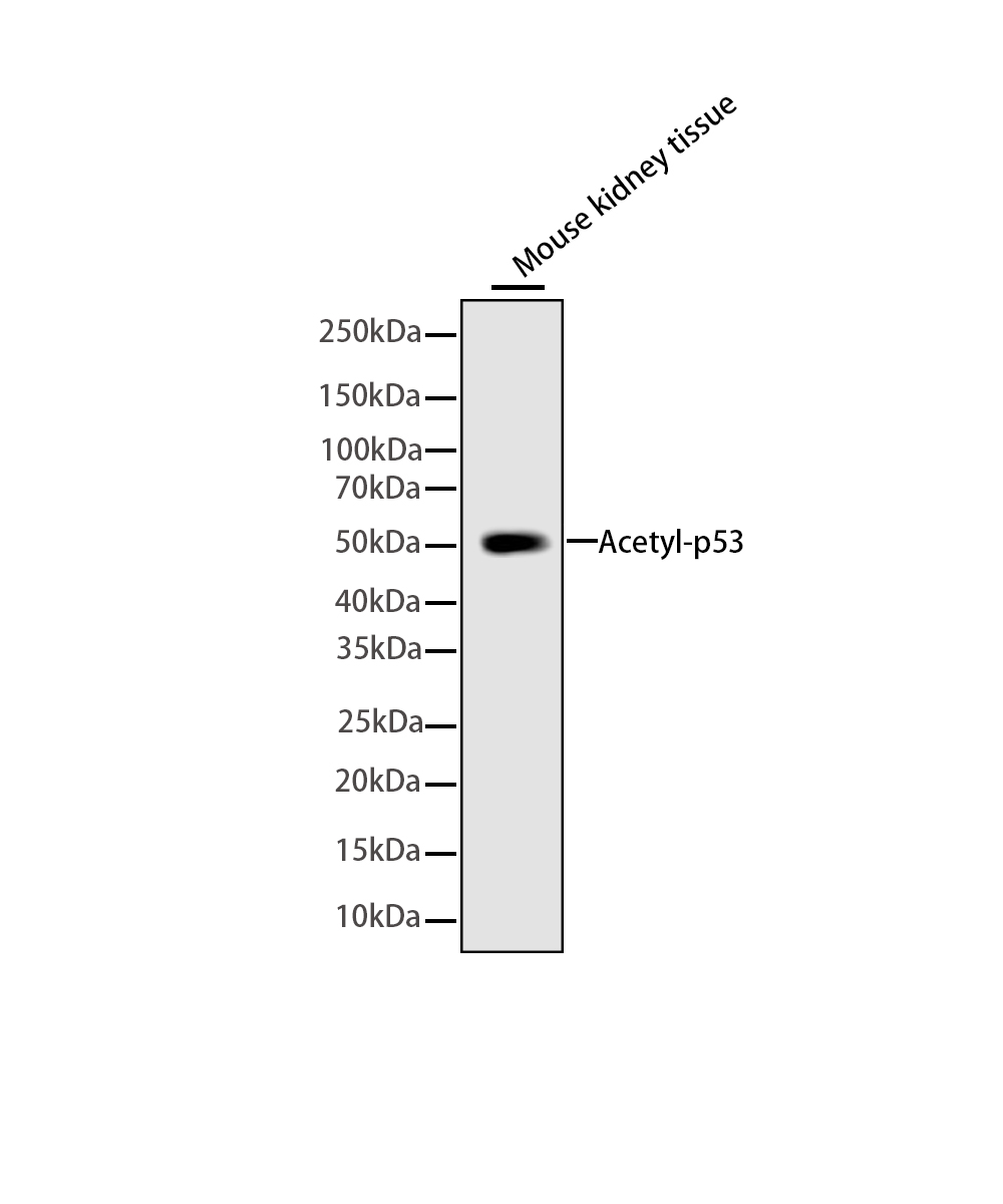 Acetyl-p53(Lys305)Rabbit mAb