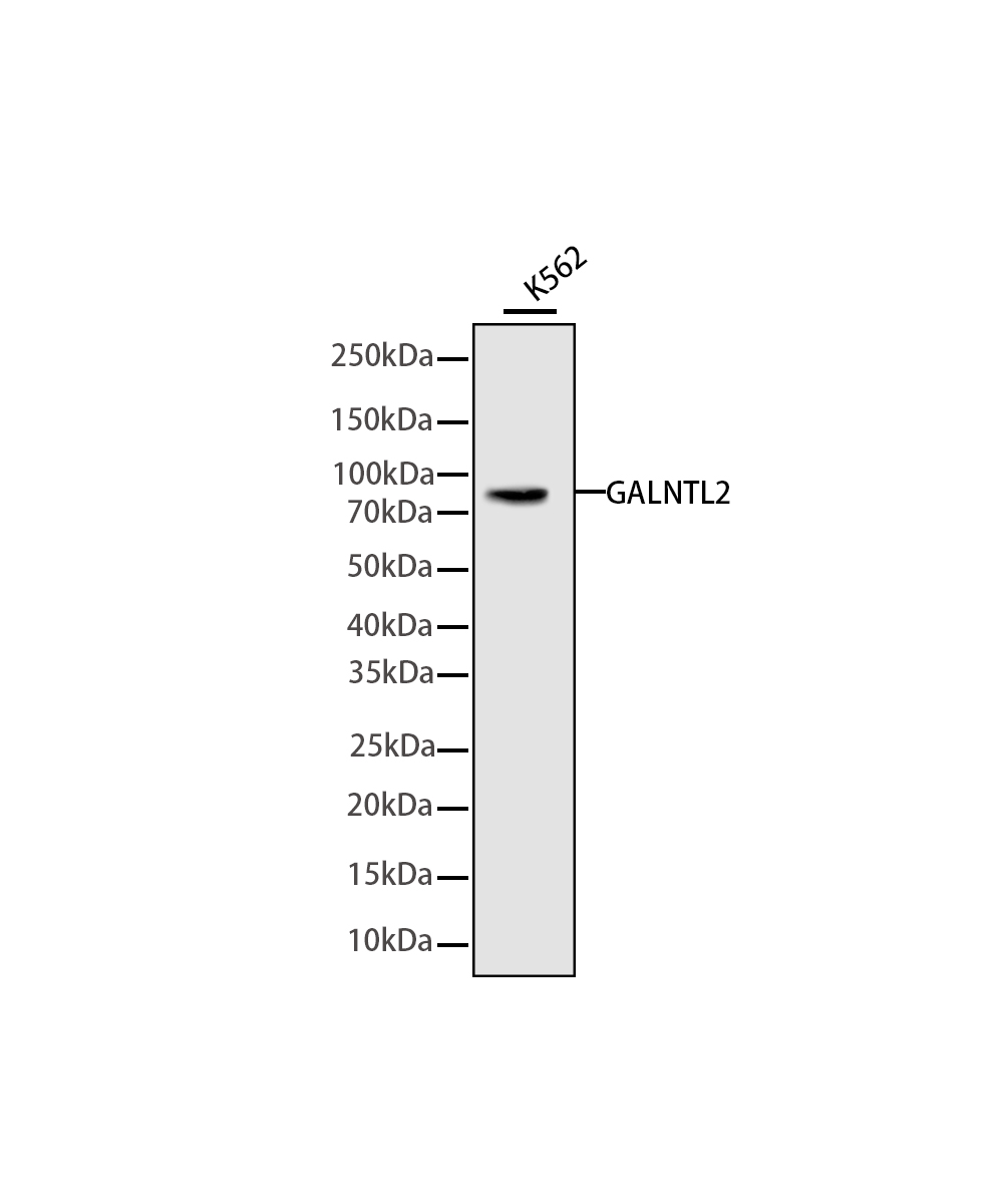 GALNTL2 Rabbit mAb