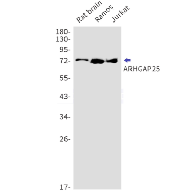 ARHGAP25 Rabbit mAb