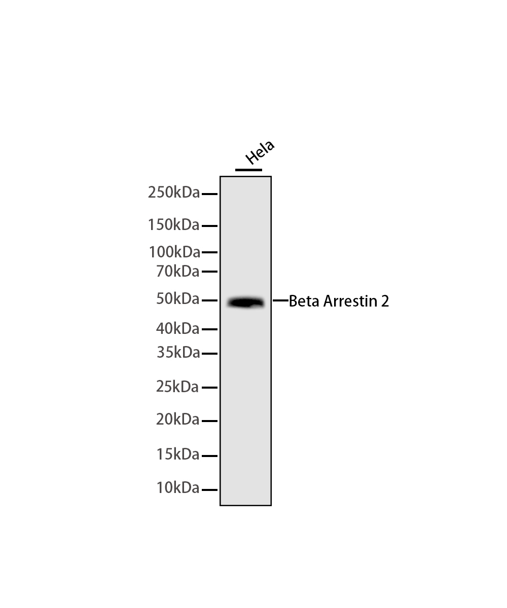 Beta Arrestin 2 Rabbit mAb