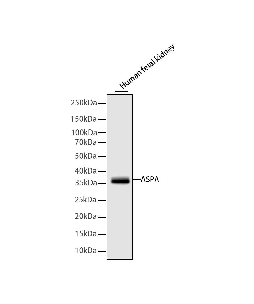 ASPA Rabbit mAb