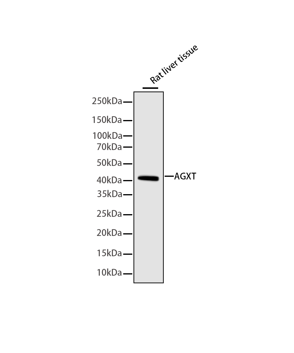 AGXT Rabbit mAb