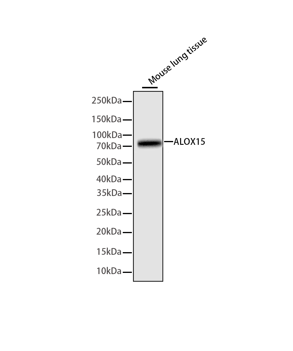 ALOX15 Rabbit mAb