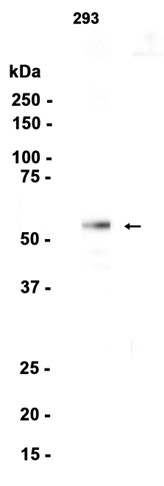 Smad2/3 Rabbit mAb