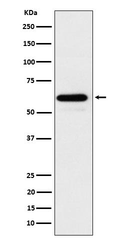 HRPT2 / CDC73 Rabbit mAb