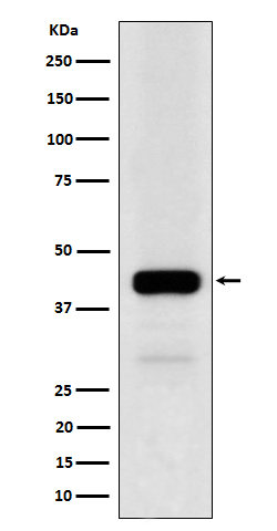NFE2 Rabbit mAb