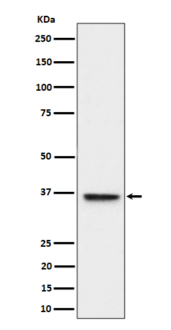ULBP1 Rabbit mAb