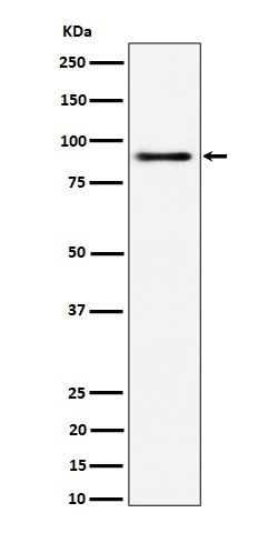 ACAP2 Rabbit mAb