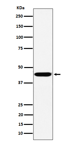 KCTD9 Rabbit mAb