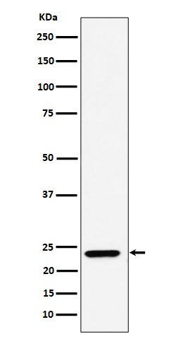 DNAJC12 Rabbit mAb