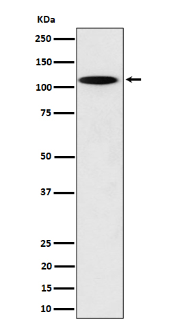 N4BP1 Rabbit mAb