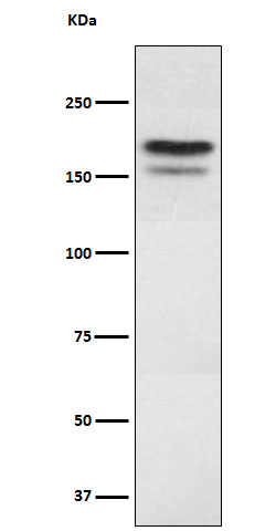 EHMT2 Rabbit mAb