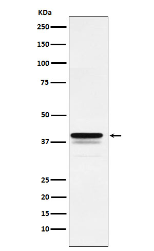 FOXF1 Rabbit mAb