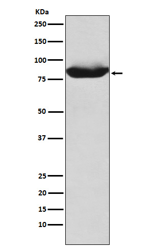 MALT1 Rabbit mAb