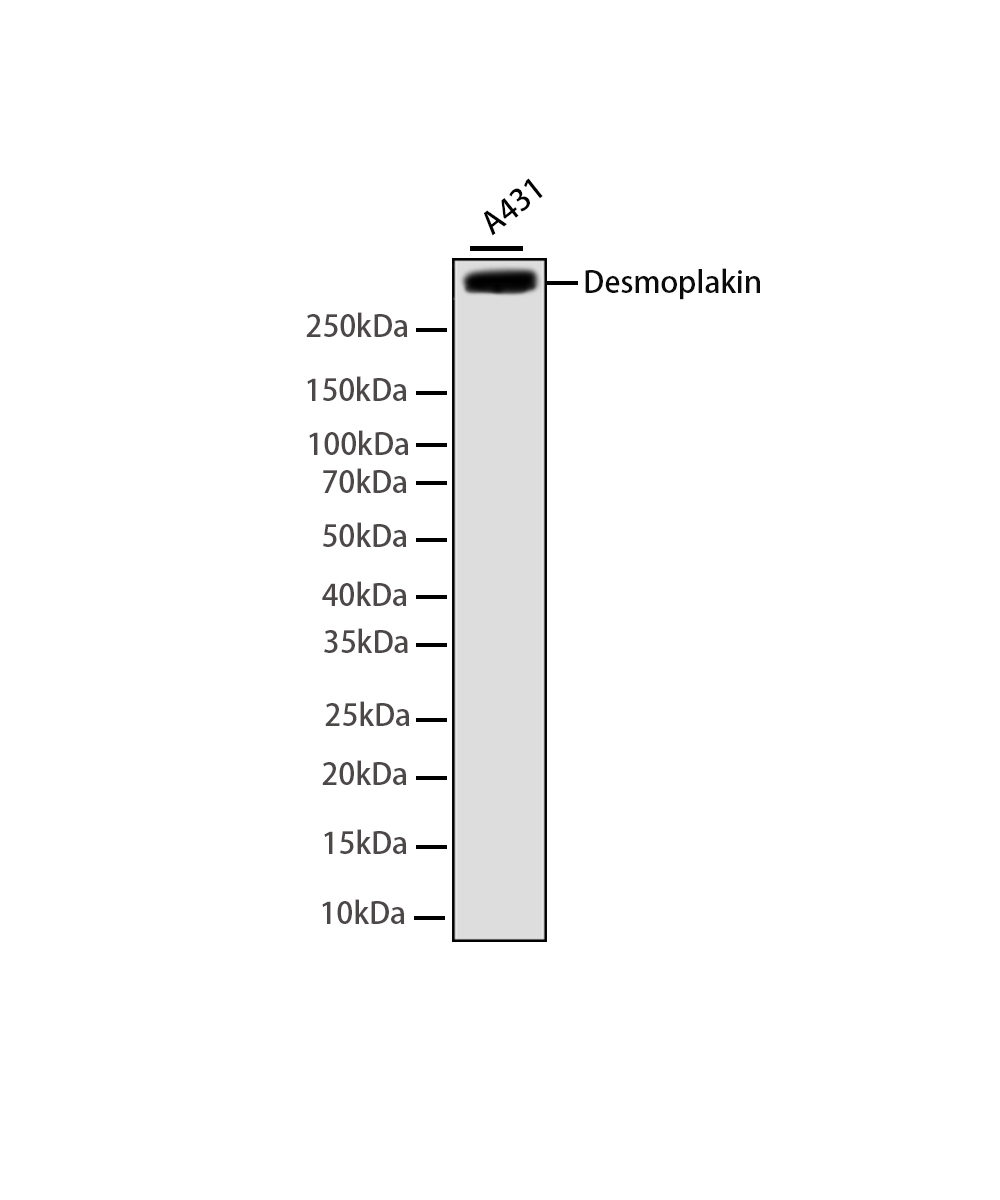 Desmoplakin Rabbit mAb