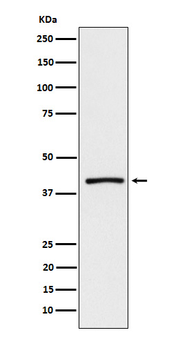 ATP1B3 Rabbit mAb