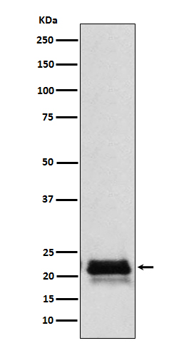 FSH beta Rabbit mAb