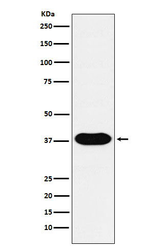 CD79B Rabbit mAb