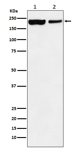 KDM5A Rabbit mAb