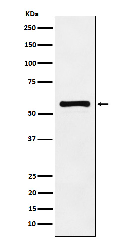 PAK2 Rabbit mAb