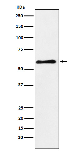 PAK3 Rabbit mAb