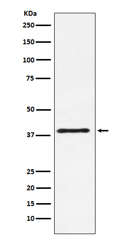 CTLA4 Rabbit mAb