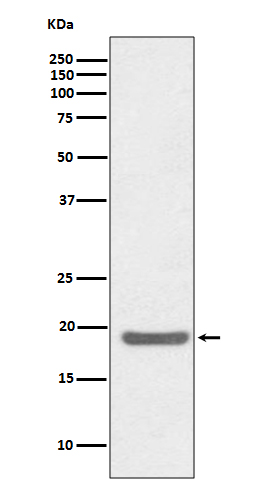 SOD1 Rabbit mAb
