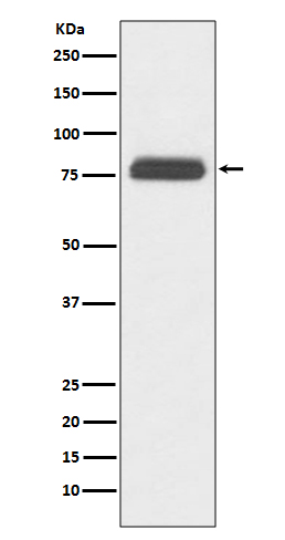 TBR1 Rabbit mAb
