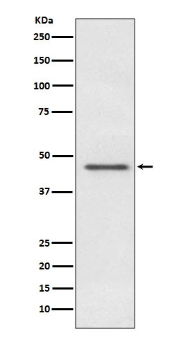 PDHA1 Rabbit mAb