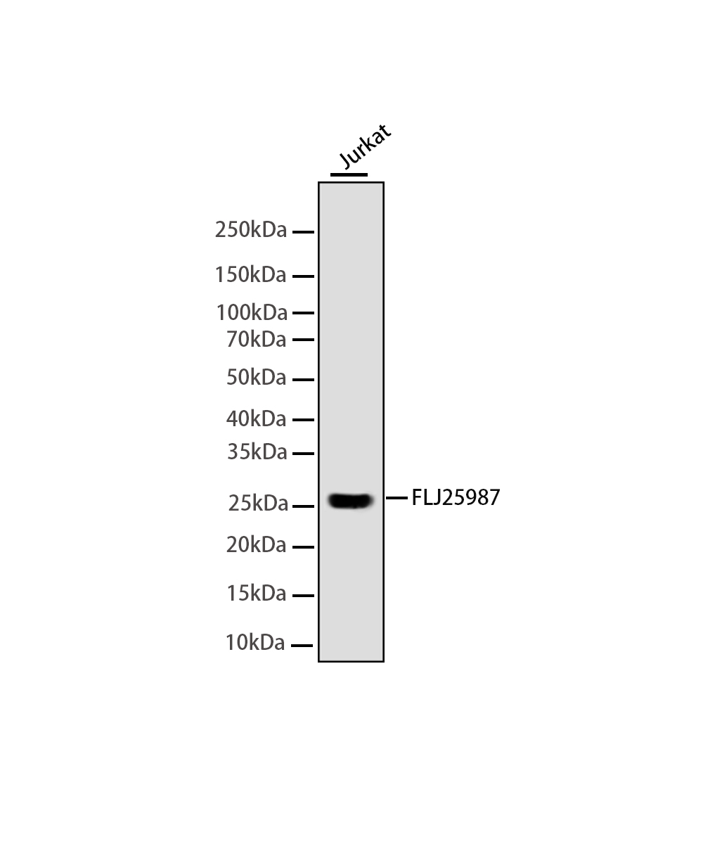 K48-linkage Specific Ubiquitin Rabbit mAb