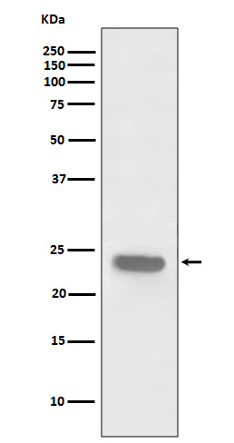 PARK7 Rabbit mAb