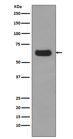 p62/SQSTM1  Rabbit mAb