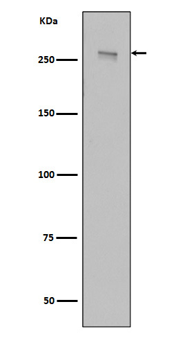 LRRK2 Rabbit mAb