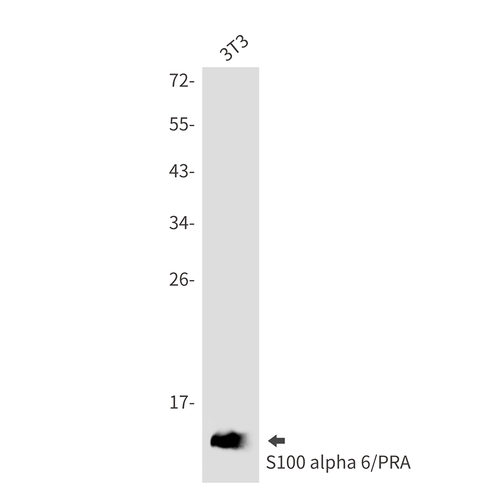 S100A6 Rabbit mAb