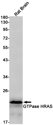 RAS Rabbit mAb