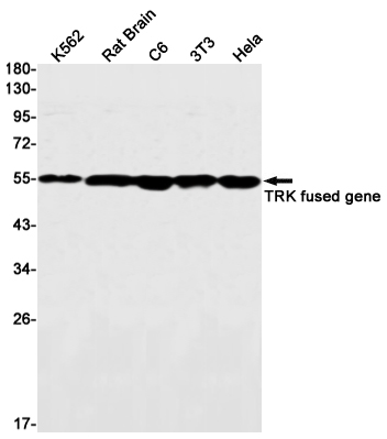 TRK fused Rabbit mAb