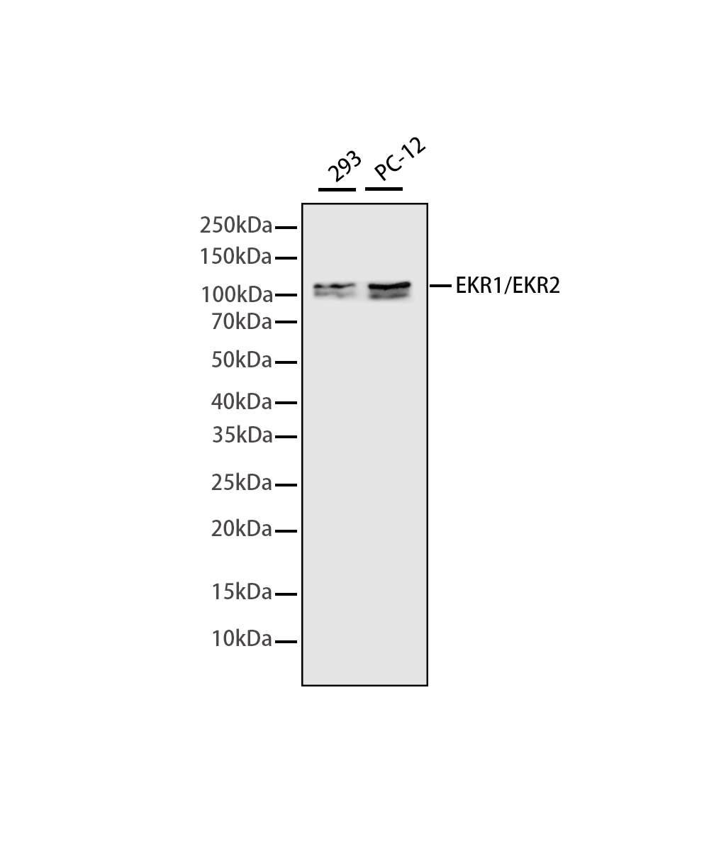 ULK1 Rabbit mAb