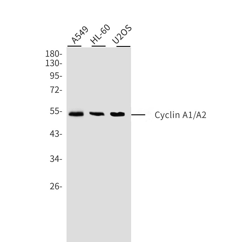 Cyclin A1/A2 Rabbit mAb