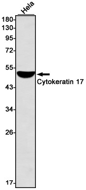 Cytokeratin 17 Rabbit mAb