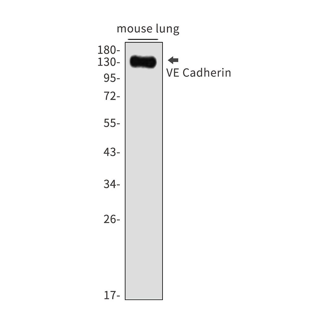 Cadherin 5 Rabbit mAb