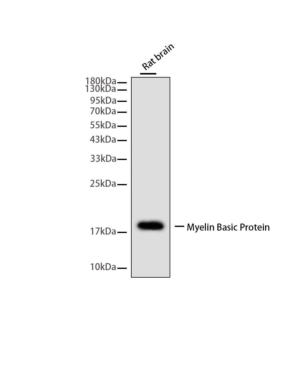 Myelin Basic Protein Rabbit mAb