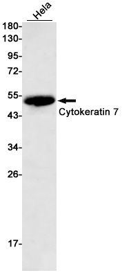 Cytokeratin 7 Rabbit mAb