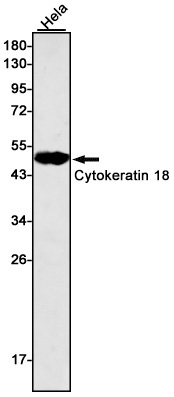 Cytokeratin 18 Rabbit mAb