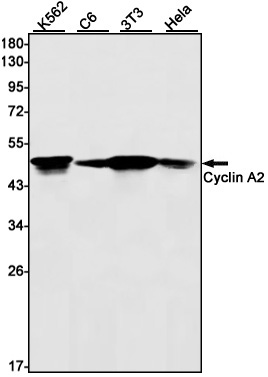Cyclin A2 Rabbit mAb